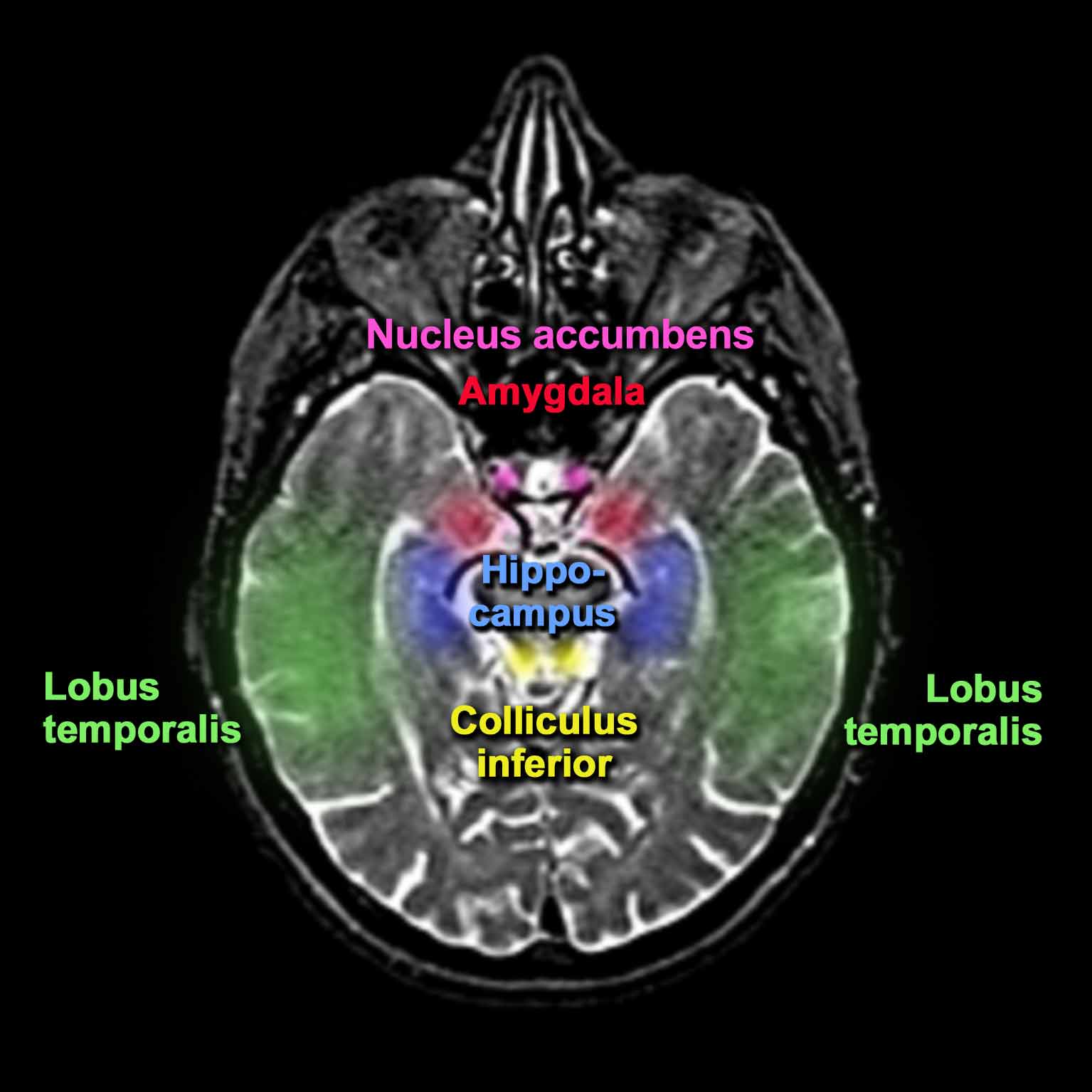anatomische Hirnansicht